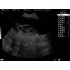 TG0402 Portable veterinary ultrasound machine, Ultrasound scanner, VET Ultrasound Diagnostic System