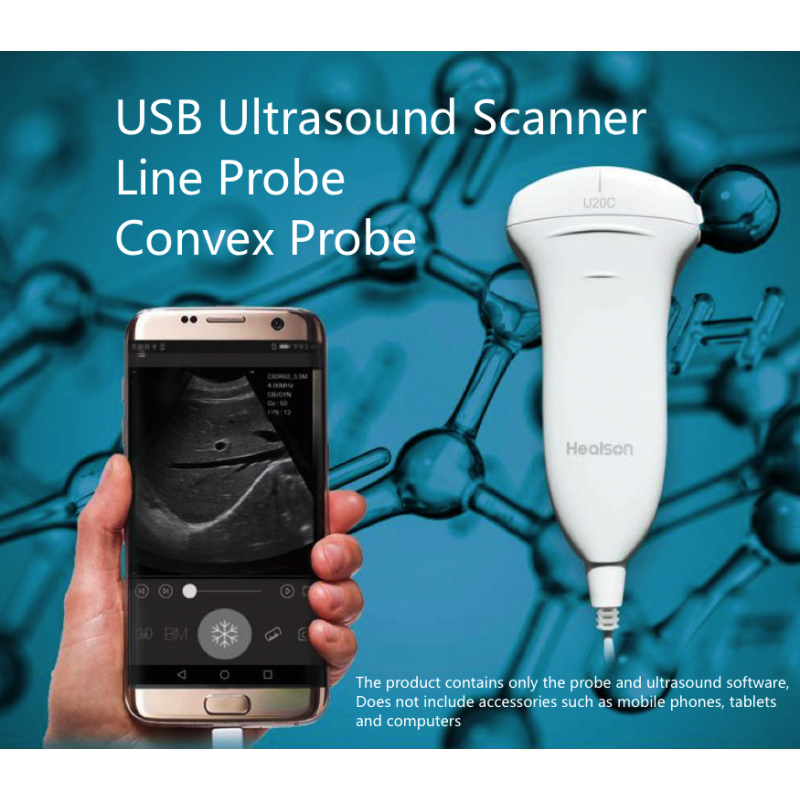 USB Ultrasound Scanner, Ultrasound Probe For Smartphone, Tablet and usb probe ultrasound scanner, Handheld USB Ultrasound Scanner Resolution