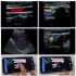 TG0430 Convex + linear 2in1 Doppler ultrasound scanner for Mobile phones and tablets, USB Convex + linear ultrasound scanner for human / Veterinary
