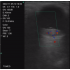 TG0433  Ophthalmology Color Doppler Ultrasound Machine, Vascular access and Peripheral nerve blocks, 10/14MHz Wireless Linear Ultrasound