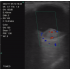 TG0433  Ophthalmology Color Doppler Ultrasound Machine, Vascular access and Peripheral nerve blocks, 10/14MHz Wireless Linear Ultrasound