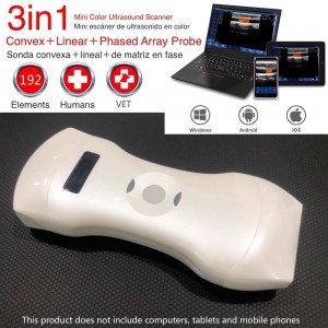 TG0439 192 Elements Wireless Color Doppler Ultrasound Convex＋Linear＋Phased array probe Double head 3 in 1