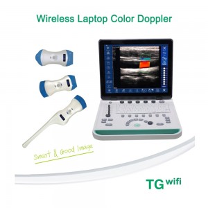 TG0440 Wireless Laptop Color Doppler