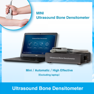 TG0450 Ultrasound Bone Densitometer
