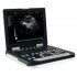 TG0451 Ultrasound machine, Ultrasound Diagnostic System, Laptop ultrasound machine